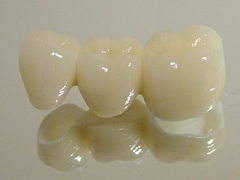 ジルコニアブリッジ臼歯の写真